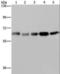 G Protein Nucleolar 3 antibody, LS-C405211, Lifespan Biosciences, Western Blot image 