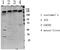 Insulin Like Growth Factor 1 Receptor antibody, STJ99596, St John
