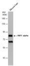 HNF1 Homeobox A antibody, GTX628240, GeneTex, Western Blot image 