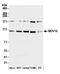 Mov10 RISC Complex RNA Helicase antibody, A500-009A, Bethyl Labs, Western Blot image 