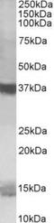 Prefoldin Subunit 1 antibody, TA311241, Origene, Western Blot image 