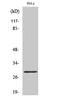 RAB20, Member RAS Oncogene Family antibody, A11018, Boster Biological Technology, Western Blot image 