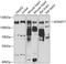 ADAM Metallopeptidase Domain 17 antibody, A00604-2, Boster Biological Technology, Western Blot image 