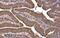 Heat Shock Protein Family A (Hsp70) Member 5 antibody, NBP2-16749, Novus Biologicals, Immunohistochemistry paraffin image 