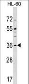 Centromere Protein O antibody, LS-C159334, Lifespan Biosciences, Western Blot image 