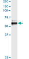 Matrix Metallopeptidase 13 antibody, LS-C197693, Lifespan Biosciences, Immunoprecipitation image 