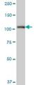 SH3 Domain Containing Ring Finger 1 antibody, H00057630-M01, Novus Biologicals, Western Blot image 