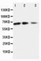 C-X3-C Motif Chemokine Ligand 1 antibody, LS-C312567, Lifespan Biosciences, Western Blot image 