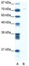 Aspartate Beta-Hydroxylase antibody, TA335750, Origene, Western Blot image 