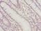 Polo Like Kinase 1 antibody, LS-C397140, Lifespan Biosciences, Immunohistochemistry frozen image 