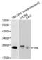 Von Hippel-Lindau Tumor Suppressor antibody, abx000699, Abbexa, Western Blot image 