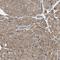 Pyruvate Dehyrogenase Phosphatase Catalytic Subunit 1 antibody, NBP1-82432, Novus Biologicals, Immunohistochemistry paraffin image 