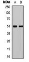 Coagulation Factor IX antibody, orb234837, Biorbyt, Western Blot image 
