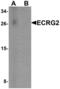 Serine Peptidase Inhibitor, Kazal Type 7 (Putative) antibody, LS-B9599, Lifespan Biosciences, Western Blot image 