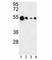 Absent In Melanoma 2 antibody, F51969-0.4ML, NSJ Bioreagents, Western Blot image 