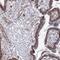 SH3 And PX Domains 2A antibody, HPA037922, Atlas Antibodies, Immunohistochemistry frozen image 