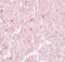 Nuclear Receptor Subfamily 1 Group H Member 3 antibody, A03331, Boster Biological Technology, Immunohistochemistry paraffin image 