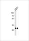 CCR4-NOT Transcription Complex Subunit 8 antibody, LS-C99242, Lifespan Biosciences, Western Blot image 