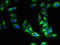 Major Facilitator Superfamily Domain Containing 5 antibody, LS-C377850, Lifespan Biosciences, Immunofluorescence image 
