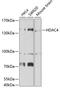 Histone Deacetylase 4 antibody, 23-304, ProSci, Western Blot image 