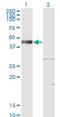 ISL LIM Homeobox 1 antibody, H00003670-M02, Novus Biologicals, Western Blot image 