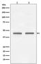 Farnesyltransferase, CAAX Box, Beta antibody, M07620, Boster Biological Technology, Western Blot image 