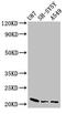 NADH dehydrogenase [ubiquinone] iron-sulfur protein 4, mitochondrial antibody, CSB-PA015663LA01HU, Cusabio, Western Blot image 