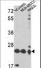 Peroxiredoxin 3 antibody, LS-C162127, Lifespan Biosciences, Western Blot image 