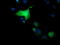 Stp antibody, TA501909, Origene, Immunofluorescence image 