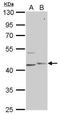 Phosphorylase Kinase Catalytic Subunit Gamma 1 antibody, GTX104019, GeneTex, Western Blot image 