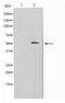 Iroquois Homeobox 2 antibody, TA347657, Origene, Western Blot image 