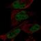 EYA Transcriptional Coactivator And Phosphatase 1 antibody, NBP2-58069, Novus Biologicals, Immunocytochemistry image 