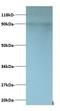 C-X-C Motif Chemokine Ligand 5 antibody, LS-C211586, Lifespan Biosciences, Western Blot image 