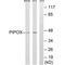 Pipecolic Acid And Sarcosine Oxidase antibody, PA5-50084, Invitrogen Antibodies, Western Blot image 