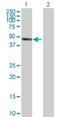Inositol Polyphosphate-5-Phosphatase A antibody, H00003632-D01P, Novus Biologicals, Western Blot image 