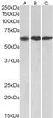 Matrix Metallopeptidase 14 antibody, LS-B11189, Lifespan Biosciences, Western Blot image 