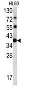 Chloride Nucleotide-Sensitive Channel 1A antibody, AP17218PU-N, Origene, Western Blot image 