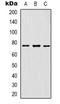 GRB2 Associated Binding Protein 1 antibody, orb318919, Biorbyt, Western Blot image 