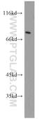 Muskelin 1 antibody, 14735-1-AP, Proteintech Group, Western Blot image 