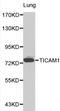 Toll Like Receptor Adaptor Molecule 1 antibody, A01872, Boster Biological Technology, Western Blot image 