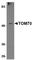 Translocase Of Outer Mitochondrial Membrane 70 antibody, ab83841, Abcam, Western Blot image 