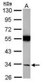 Torsin Family 1 Member A antibody, GTX113421, GeneTex, Western Blot image 