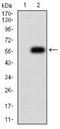 TNF Superfamily Member 11 antibody, NBP2-61813, Novus Biologicals, Western Blot image 