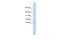 ER Membrane Protein Complex Subunit 6 antibody, A14888, Boster Biological Technology, Western Blot image 