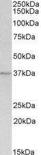 Meis Homeobox 1 antibody, 46-767, ProSci, Enzyme Linked Immunosorbent Assay image 