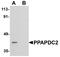 Phospholipid Phosphatase 6 antibody, A14868, Boster Biological Technology, Western Blot image 