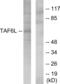 TATA-Box Binding Protein Associated Factor 6 Like antibody, abx013875, Abbexa, Western Blot image 