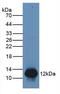 S100 Calcium Binding Protein A8 antibody, abx131995, Abbexa, Western Blot image 