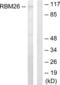 RNA Binding Motif Protein 26 antibody, LS-C119099, Lifespan Biosciences, Western Blot image 