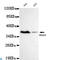 Protein Arginine Methyltransferase 6 antibody, LS-C813101, Lifespan Biosciences, Western Blot image 